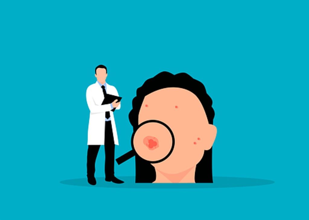 Fasting To Cure Acne